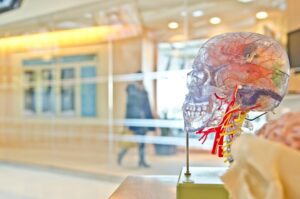 Photo Image: Brain scan