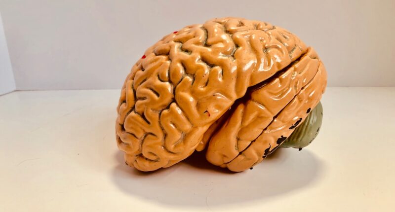 Photo Image: Brain scan