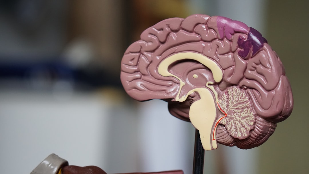 Photo 1 Brain scan 2 Neurotransmitters