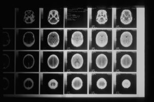 Photo brain scan