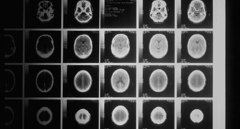 Photo brain scan