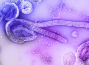 Photo Medical illustration